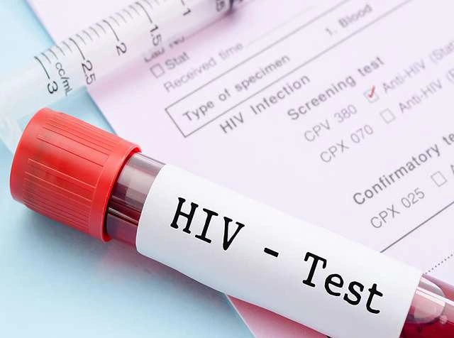 More HIV testing could help stop new cases in England by 2030